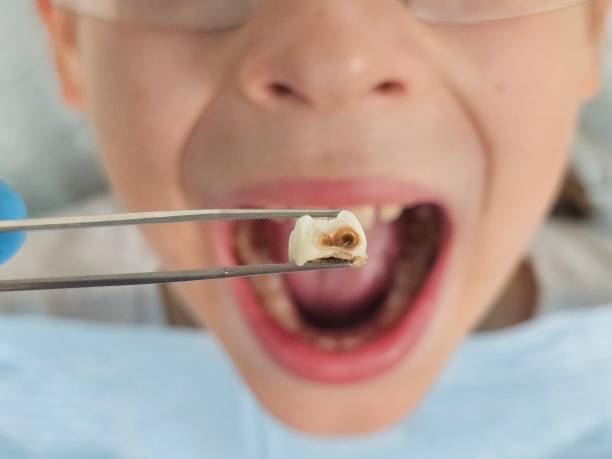 Best Urgent Tooth Repair  in Grangeville, ID
